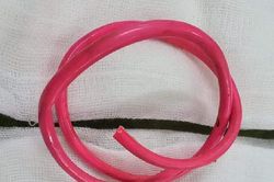 Phát hiện 30cm dây điện trong bàng quang một người đàn ông
