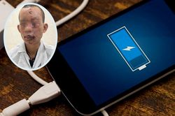 Mù mắt, gãy tay do điện thoại phát nổ khi đang sạc