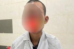 Bệnh nhân bị cháy sém, nguy cơ mù khi vừa dùng điện thoại vừa sạc