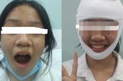 Ngáp to không ngậm được miệng, cần đưa ngay đến bệnh viện
