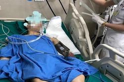 Nam thanh niên 25 tuổi nguy kịch sau khi hút điếu thuốc lào