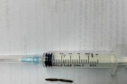 Cứu sống bệnh nhân tai nạn lao động hy hữu với vết thương ở tim