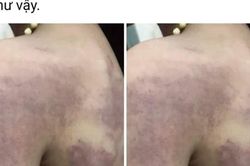 Nghi vấn cô giáo đánh học sinh lớp 3 do không thuộc bài