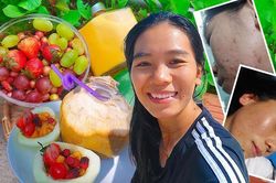 Người phụ nữ 'lột xác' sau 10 năm trị mụn vất vả cùng đủ thứ bệnh