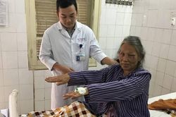 Cứu bệnh nhân 73 tuổi nhồi máu não bằng phương pháp tiêu sợi huyết
