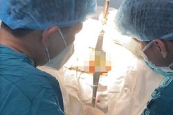 Nam thanh niên nhập viện vì nhét dưa chuột vào hậu môn tìm cảm giác lạ