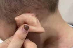 Nghi vấn bé gần 2 tuổi bị bạo hành trong trung tâm giáo dục chuyên biệt
