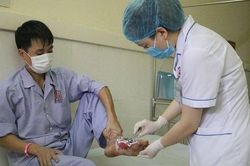 Hoại tử bàn chân do chữa bỏng theo lời thầy lang
