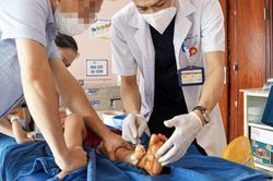 Trẻ dập nát bàn chân vì cổng trượt tự động