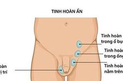Con phải cắt bỏ tinh hoàn vì sự chủ quan của cha mẹ