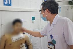 Sau cuộc cãi vã, nam thanh niên bị đâm xuyên ngực