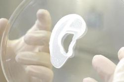 Công nghệ in 3D tái tạo tai