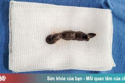 Gắp con đỉa còn sống từ khí quản bé 4 tuổi
