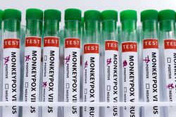 Anh mở rộng tiêm vaccine đậu mùa khỉ cho toàn dân