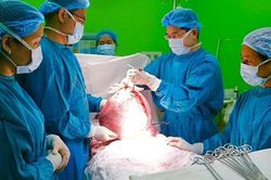 Bóc tách khối u như thai 9 tháng cho một nữ bệnh nhân