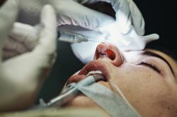 Liều mình nâng mũi, hút mỡ ở nước ngoài bất chấp rủi ro