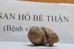 Thói quen thường gặp khiến thận mất hoàn toàn chức năng