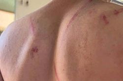 Bé 9 tuổi bị bố và bà nội bạo hành