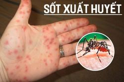 Đã có 92.000 người mắc sốt xuất huyết, 36 ca tử vong