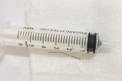 Phát hiện dây thép trong họng sau nửa năm