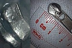 Nội soi gắp dị vật ra khỏi dạ dày bé trai 6 tuổi ở Đắk Lắk