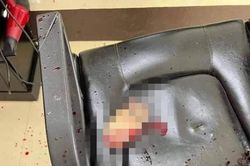 Chủ salon kể lại giây phút kinh hoàng khi chứng kiến khách bị chém đứt lìa bàn tay lúc đang cắt tóc