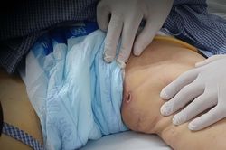 Suy hô hấp, đi nhiều chuyên khoa mới tìm ra thủ phạm là một loại côn trùng cắn