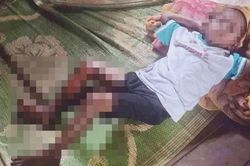 Xác minh thông tin bé trai ở Đắk Lắk trộm trái cây bị tẩm xăng đốt