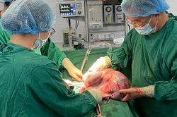 Cô gái 26 tuổi có khối u buồng trứng nặng 10kg