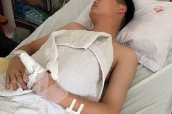 Bắt giữ nam thanh niên 18 tuổi chém nhiều nhát vào người thiếu úy công an
