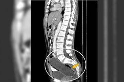 Ham trò mới mẻ khi ân ái, người đàn ông khiến bác sĩ sốc