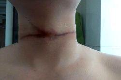 Chàng trai chia sẻ sự cố trời giáng từ dây diều khiến dân mạng rùng mình
