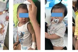 Nhiều trẻ dưới 1 tuổi nguy kịch vì sốt xuất huyết do nhầm với bệnh khác