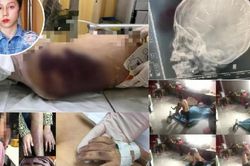 Những vụ bạo hành trẻ em gây rúng động