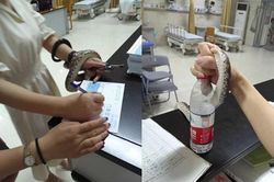 Xanh mặt chứng kiến cô gái điềm tĩnh cầm rắn sống bước vào phòng cấp cứu