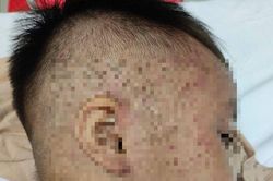 Sức khỏe của bé trai 3 tuổi nghi bị cho vào tủ cấp đông