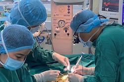 Bộ Y tế lên tiếng việc nhiều viện 'kêu' thiếu thuốc chống đông, nguy cơ phải ngưng mổ tim