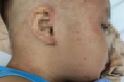 Cấp cứu bé trai 4 tuổi bị bạo hành nhét vào tủ đông