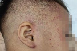 Bé trai hơn 3 tuổi bị nhốt vào tủ đông có thể xuất viện chiều nay