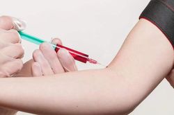 Yêu dại dột, thiếu nữ 15 tuổi tự tiêm máu bạn trai nhiễm HIV vào người