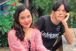 'Tình yêu cổ tích' của chàng trai có gương mặt biến dạng