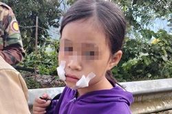 Bé gái 9 tuổi bị cướp khi bán hoa quả bên đường