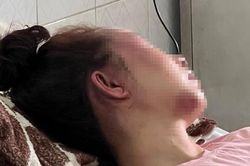 Một phụ nữ bị bạn trai 'tra tấn' suốt 4 tiếng, chỉ vì hát song ca với người khác