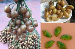 Vừa ăn vừa cười, bé trai gặp tai nạn nguy hiểm: Bác sĩ cảnh báo