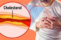 Thờ ơ với tình trạng thừa cholesterol, gần 50% người thành thị bị mỡ máu cao