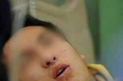 Ăn món nhiều người cho là đại bổ, người đàn ông bị chẩn đoán suy thận