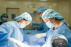 Cắt khối u buồng trứng bị hoại tử nặng khoảng 1kg cho nữ bệnh nhân