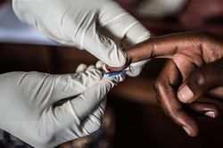 Lộ trình xóa sổ bệnh AIDS, lao, sốt rét của thế giới đang bị chậm lại