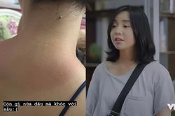 Quỳnh Kool hy sinh vì nghệ thuật, nhìn làn da mà thấy thương!