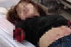 Đấu tranh làm rõ hành vi côn đồ của gã chồng chém đứt lìa 2 cánh tay vợ